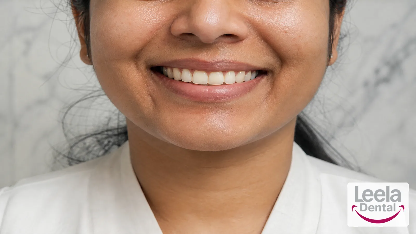 A natural smile after dental care.